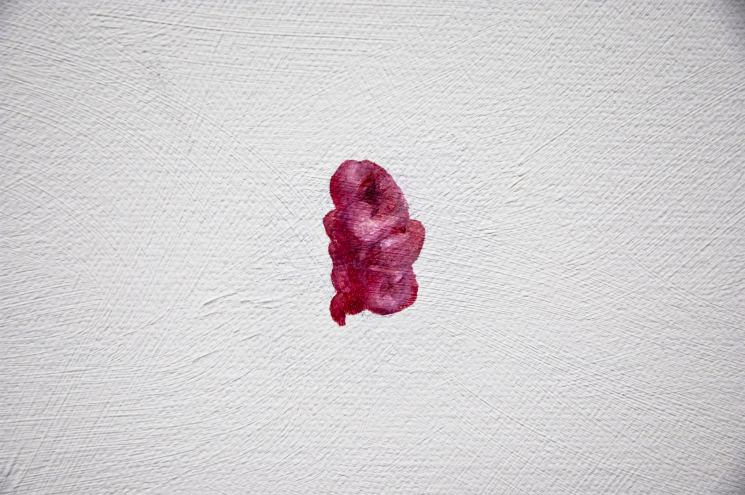 Object (gum, stomach, intestine)